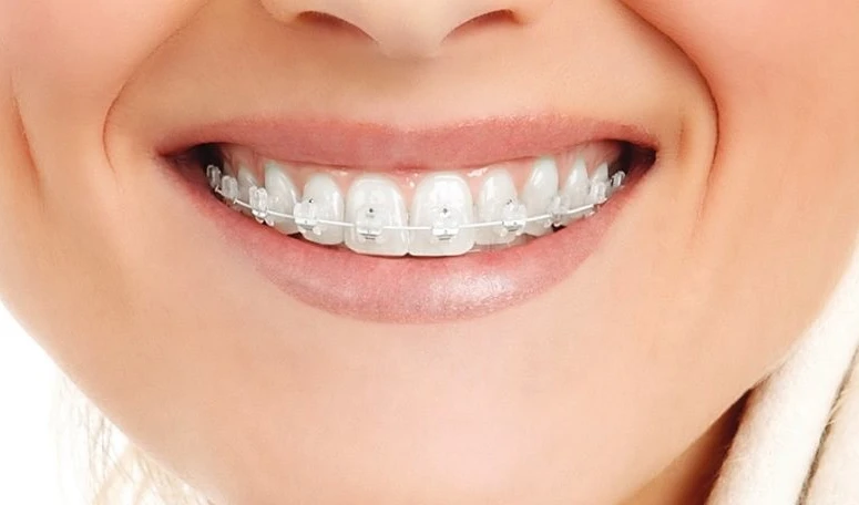 Aparelhos Esteticos Aparelhos Esteticos