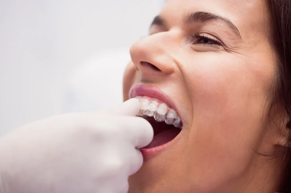 Dentista Ajustando O Aparelho Invisalign Em Um Paciente Na Clinica Odontologica Dentista Ajustando O Aparelho Invisalign Em Um Paciente Na Clinica Odontologica