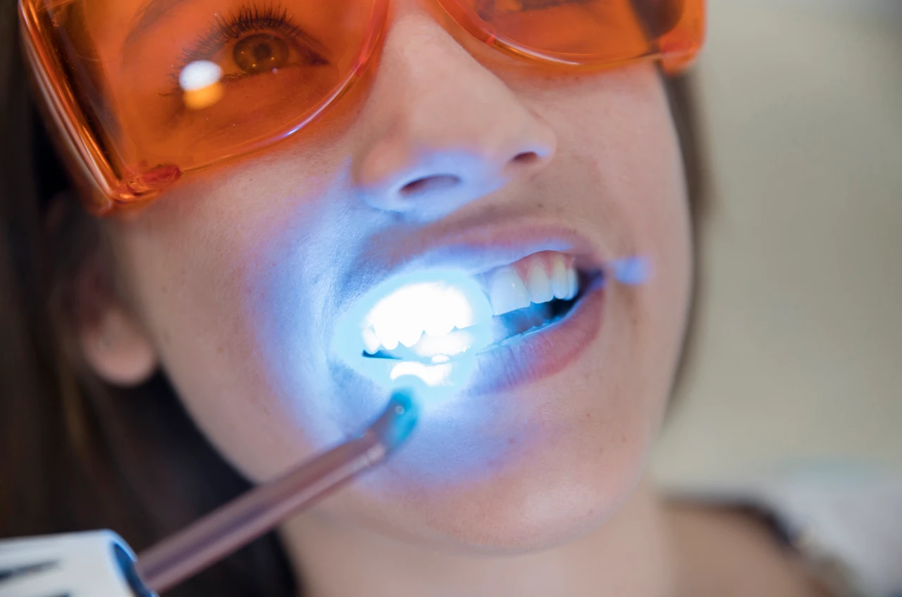 Dentista Realizando Clareamento Dental A Laser Dentista Realizando Clareamento Dental A Laser