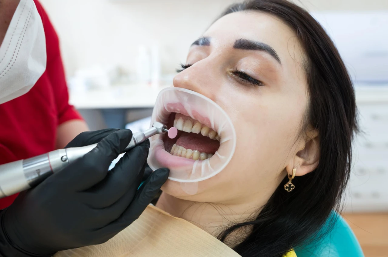Dentista Realizando Limpeza Profunda Nos Dentes De Paciente Dentista Realizando Limpeza Profunda Nos Dentes De Paciente