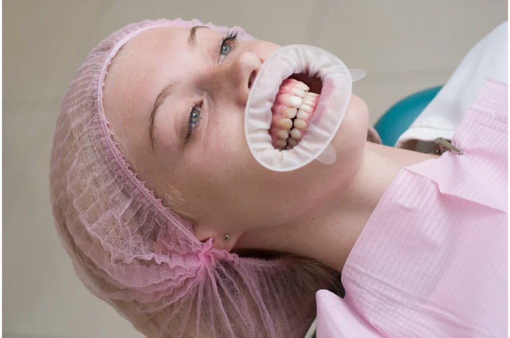 Caries E Estetica Dentaria Dentista Caries E Estetica Dentaria Dentista