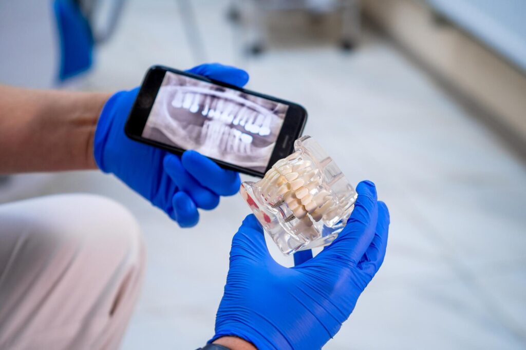 Artificial Plastic Jaw With Dental Implants Training Doctor S Hands Showing Curing Methods Compairing With Xray Closeup 116317 16745 Artificial Plastic Jaw With Dental Implants Training Doctor S Hands Showing Curing Methods Compairing With Xray Closeup 116317 16745