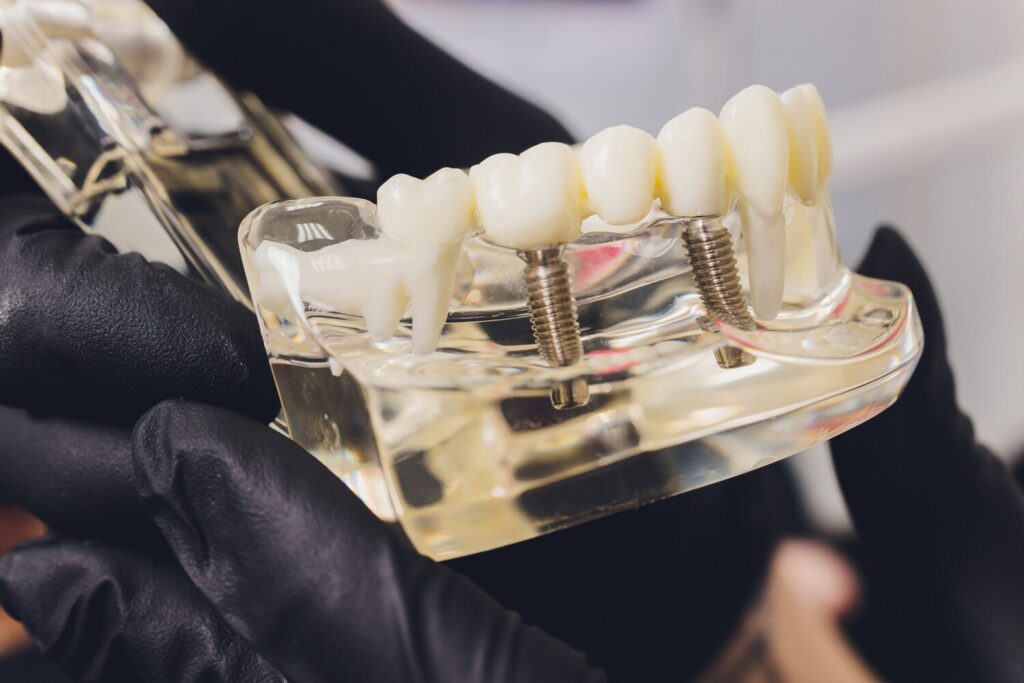 Orthodontist Holds Jaw His Hands Training Package With Capillaries Roots Pins 152904 7686 Orthodontist Holds Jaw His Hands Training Package With Capillaries Roots Pins 152904 7686