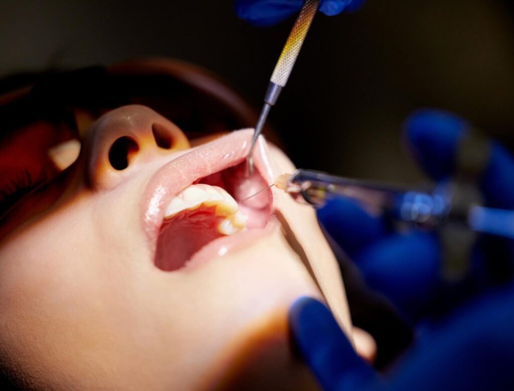 Person Mouth Tools With Woman Dentist Oral Hygiene Dental Care Appointment Closeup Hands Healthcare Medical Equipment With Patient Chair Clinic Operation Surgery 590464 401319 Person Mouth Tools With Woman Dentist Oral Hygiene Dental Care Appointment Closeup Hands Healthcare Medical Equipment With Patient Chair Clinic Operation Surgery 590464 401319
