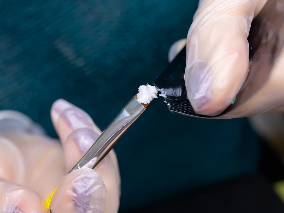 fechamento de diastema com resina
